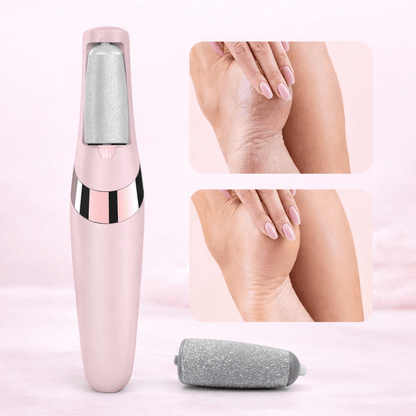 ⚡ LAST CHANCE: 50% OFF! 🔥Electric Foot Callus Remover – Smooth Feet in Seconds! 🦶✨